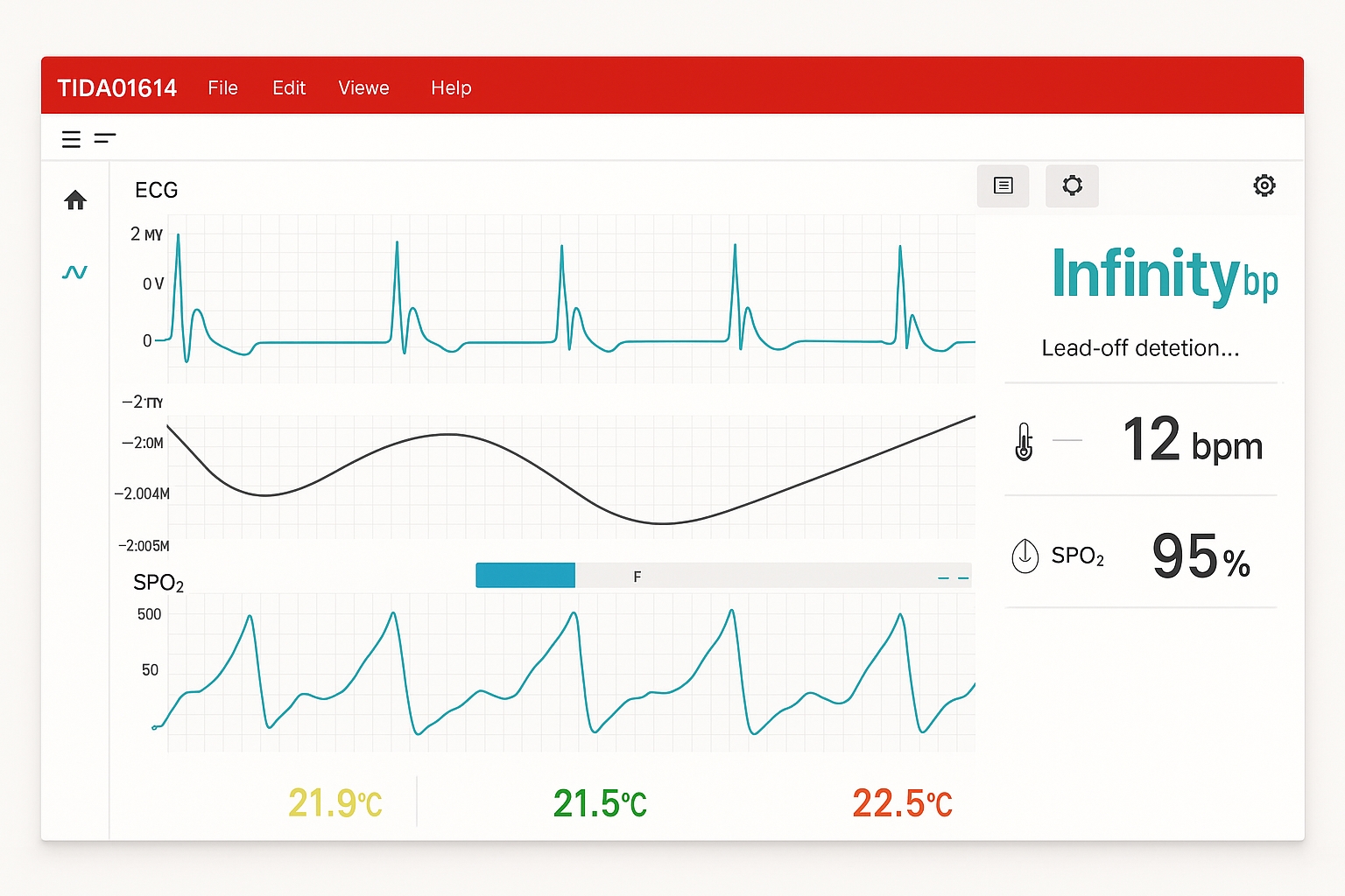 Figure 3 GUI showing ECG PPG pacemaker heart rate and skin temperature