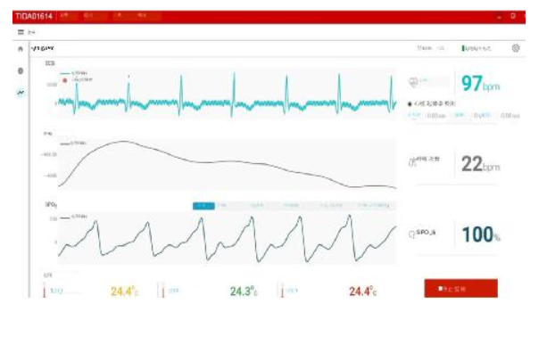 GUI showing ECG PPG respiration heart rate skin temperature