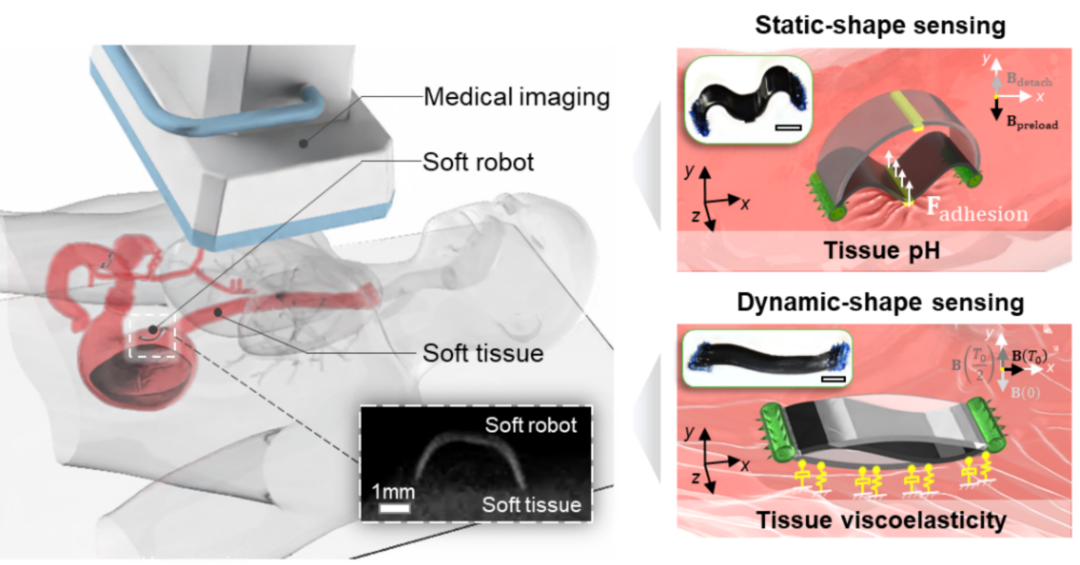 System for detecting soft tissue physiological properties using wireless miniature soft robots