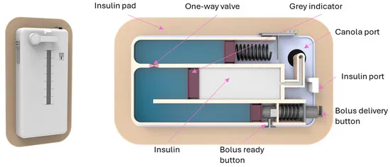 Material Matters: Selecting the Right PCB Materials for Reliable Insulin Pumps