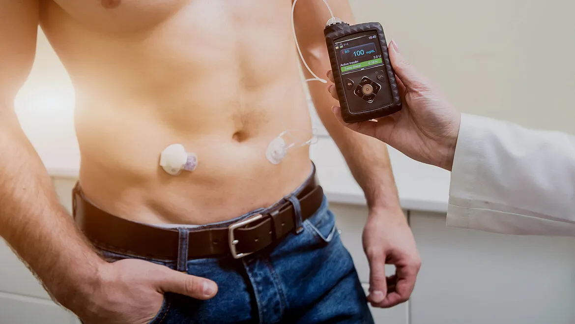 Designing for Life: Key PCB Considerations in Insulin Pumps