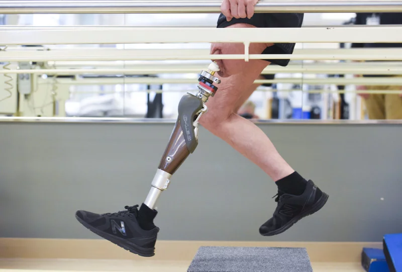 Textile Based Pressure Sensors for Prosthetic Socket Interfaces