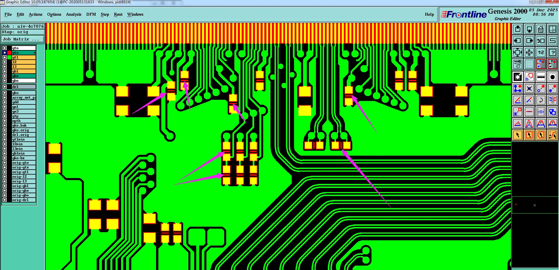 How DFM Prevented SMT Shorts from Narrow Mask Bridges