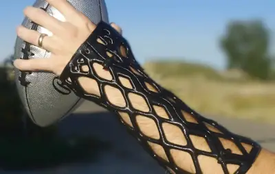 3D-Printed Medical Splints for Orthopedic Use