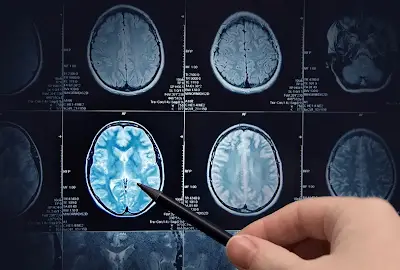 Core Areas and Current State of Medical Image Processing