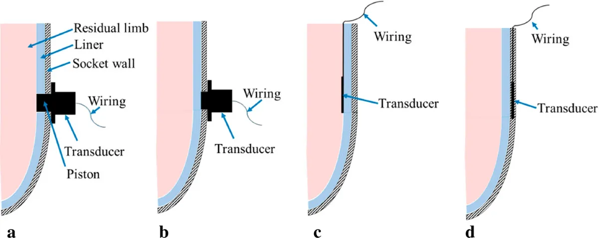 Textile sensor integration in prosthetic liner