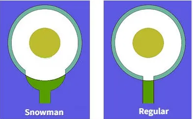 PCB teardrops comparison - standard tapered shape versus snowman style reinforcements at trace-to-pad junctions